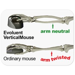 Evoluent VerticalMouse 3,  right hand