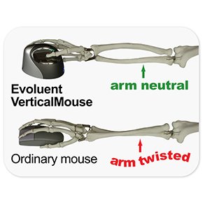 Evoluent VerticalMouse 3,  right hand