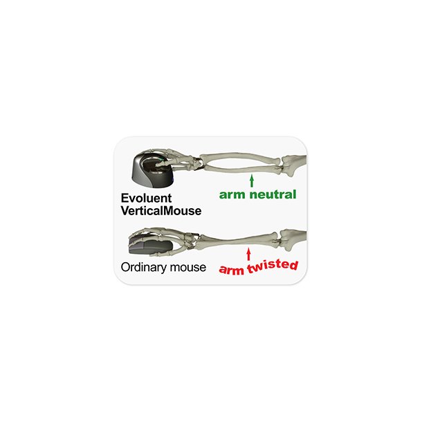 Evoluent VerticalMouse 4right hand small